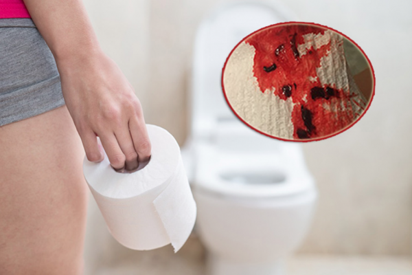 8 Địa chỉ khám đi đại tiện ra máu ở đâu tốt uy tín tại Hà Nội